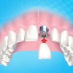 تعتبر تركيبات الزيركون واحدة من أحدث التقنيات في مجال طب الأسنان، ولقد كانت تجربتي مع هذا الإجراء حقًا مذهلة. إنها تقنية متطورة تستخدم لتحسين مظهر ووظيفة الأسنان بشكل لا يصدق. في هذا المقال، سأشارك تجربتي الشخصية مع تركيبات الزيركون وسأجيب على بعض الأسئلة الشائعة حول هذا الموضوع. تجربتي مع تركيبات الزيركون